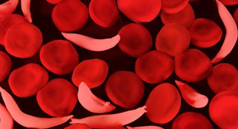 Drive to detect and treatment of Sickle Cell disease in Odisha