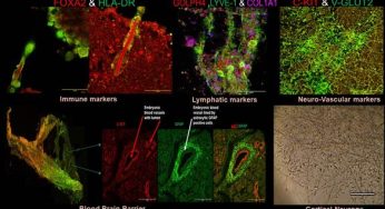 Neurovascular Organoids: PGIMER Chandigarh Unveils Innovative Model from Autologous Blood
