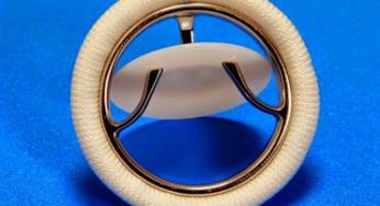 Sree Chitra Valve: A Pioneering Solution in India’s Fight Against Rheumatic Heart Disease