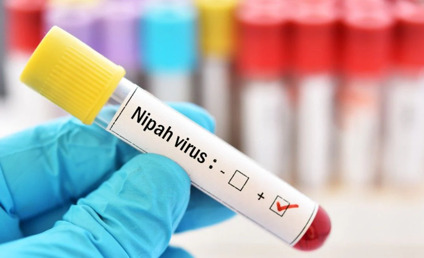 Nipah Virus Case Detected in Mallapuram, Kerala: A 14-Year-Old Boy Succumbs