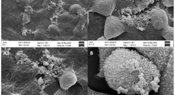New Probiotic Strain Discovered: Streptococcus thermophilus MCC0200 Shows Promise Beyond Dairy Industry