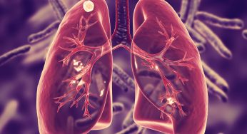 India Introduces New BPaLM Regimen to Combat Drug-Resistant Tuberculosis, Aiming for TB-Free Nation by 2025